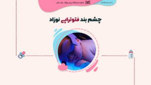 چشم بند فتوتراپی نوزاد