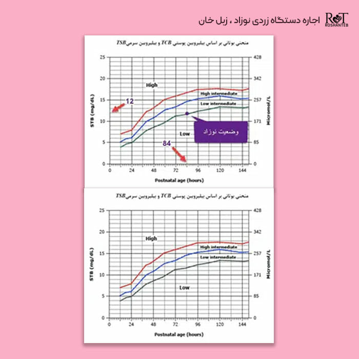 جدول درجه بندی زردی نوزاد