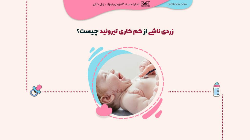 زردی ناشی از کم کاری تیروئید