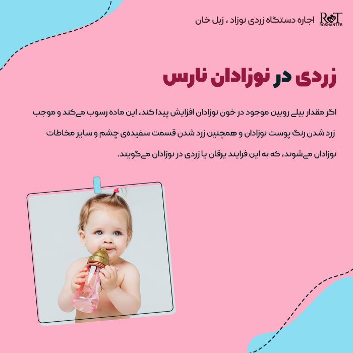 زردی در نوزادان نارس